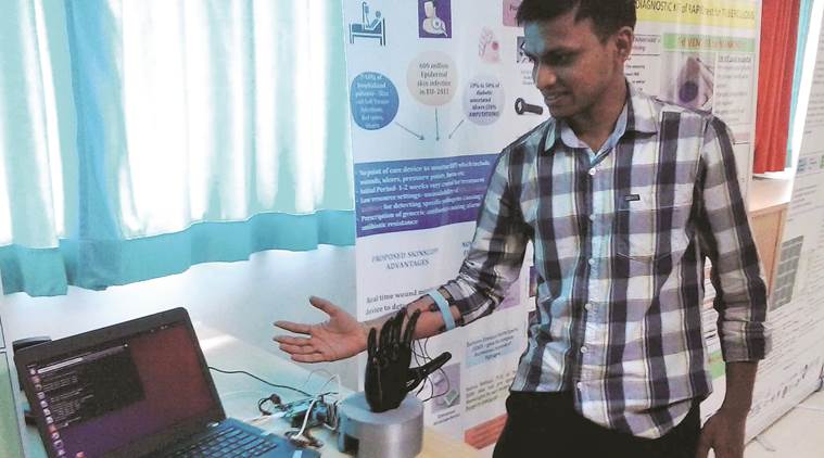 Pratik Bhalerao, a co-founder at Pune start-up Dee Dee Labs, demonstrates the working of the prosthetic hand. Photo credit: Indian Express.
