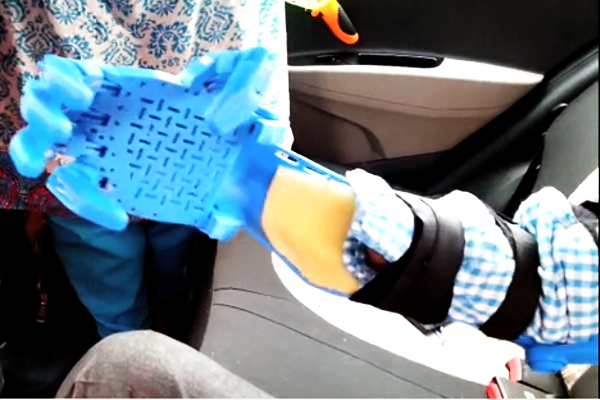 Parshuram Takalkar tries a prototype 3D printed prosthetic hand - Pune - August 5, 2016 Parshuram Takalkar tries a prototype 3D printed prosthetic hand - Pune - August 5, 2016