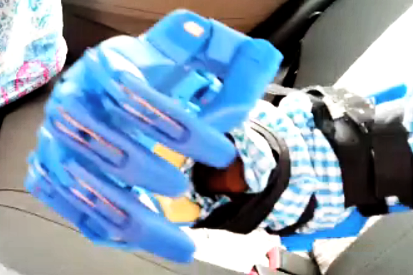 Parshuram Takalkar tries a prototype 3D printed prosthetic hand - Pune - August 5, 2016 Parshuram Takalkar tries a prototype 3D printed prosthetic hand - Pune - August 5, 2016