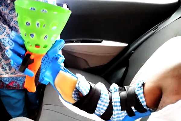 Parshuram Takalkar tries a prototype 3D printed prosthetic hand - Pune - August 5, 2016 Parshuram Takalkar tries a prototype 3D printed prosthetic hand - Pune - August 5, 2016