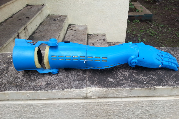 Prototype 3D printed prosthetic hand based on the e-NABLE UnLimbited arm v2.0 - Alfie Edition - Pune - August 5, 2016 Prototype 3D printed prosthetic hand based on the e-NABLE UnLimbited arm v2.0 - Alfie Edition - Pune - August 5, 2016