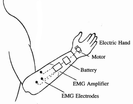 Myoelectric Hand Components Myoelectric Hand Components
