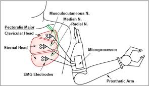 Myoelectric Hand Components