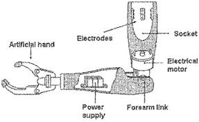 Myoelectric Hand Components