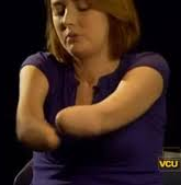 Near The Elbow Defects Near The Elbow Defects